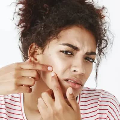 علت جوش پریودی؛ چرا قبل از قاعدگی جوش می‌زنیم؟