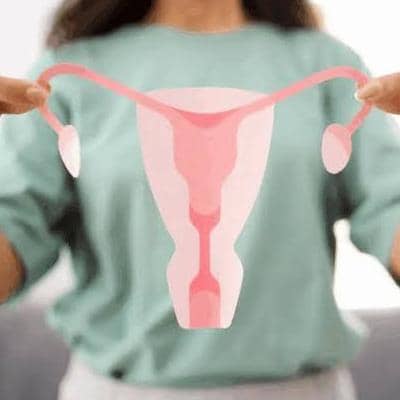 سندرم تخمدان پلی ‌کیستیک (PCOS): هر آنچه باید بدانید