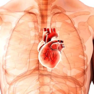 گشادی رگ‌های قلب، مهم‌ترین علل آن و راهکارهای درمانی