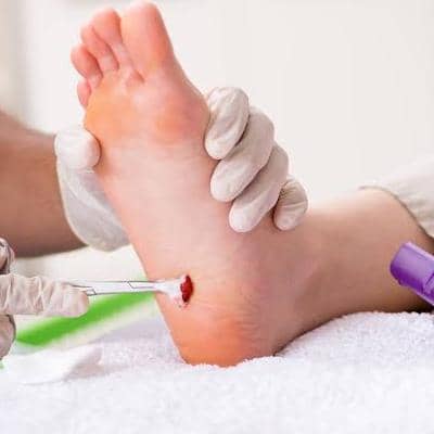 همه چیز درباره عمل پانکچر و نحوه انجام آن