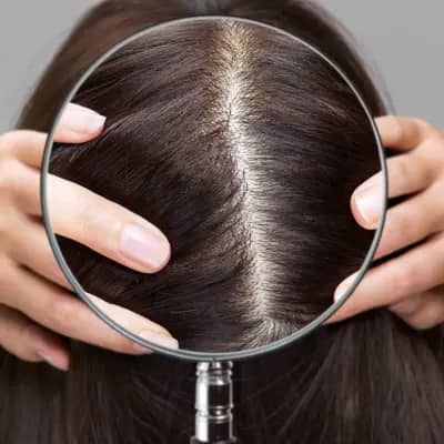 برای تقویت پوست سر چه کنیم؟ راز داشتن ریشه‌های قوی و موهای سالم