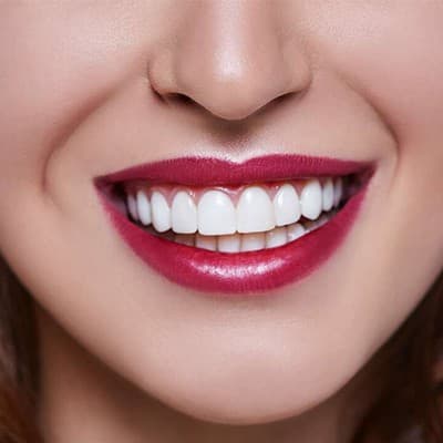 چگونه دندان های خود را در خانه سفید کنیم؟
