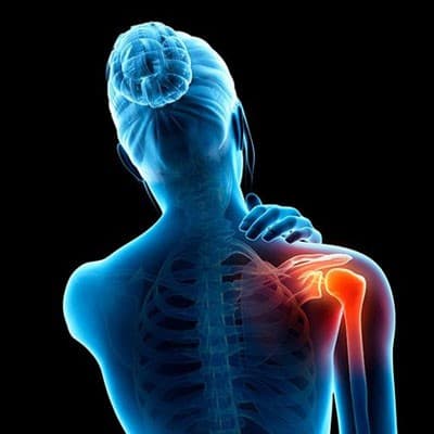 نکاتی برای سلامت مفاصل و پیشگیری از دردهای مفصلی