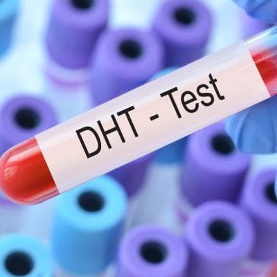 درباره هورمون DHT چه می‌دانید؟