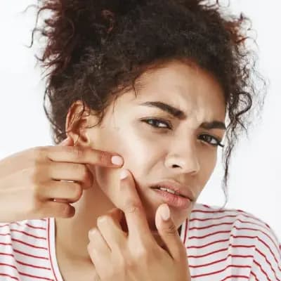 علت جوش پریودی؛ چرا قبل از قاعدگی جوش می‌زنیم؟