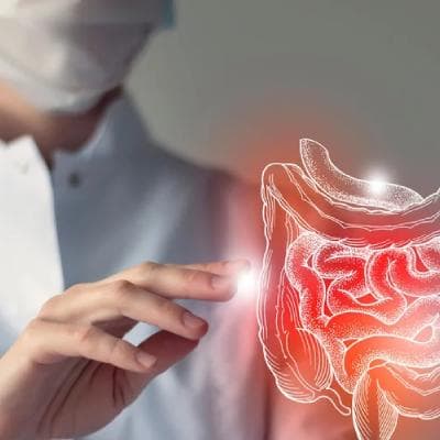 همه چیز درباره کولیت روده؛ علل، علائم و روش‌های درمان