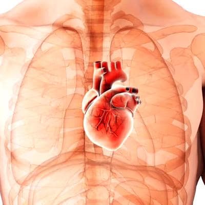 گشادی رگ‌های قلب، مهم‌ترین علل آن و راهکارهای درمانی