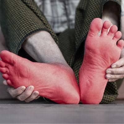 آشنایی با 7 علت داغ شدن کف پا و سوزنسوزن شدن