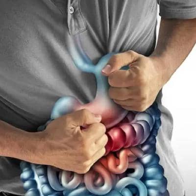 بهترین پروبیوتیک برای روده تحریک پذیر کدام است؟