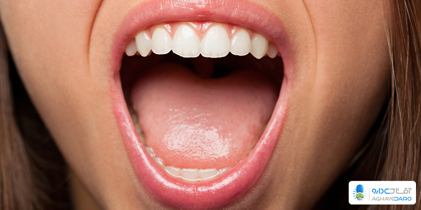 علل ابتلا به سرطان زبان