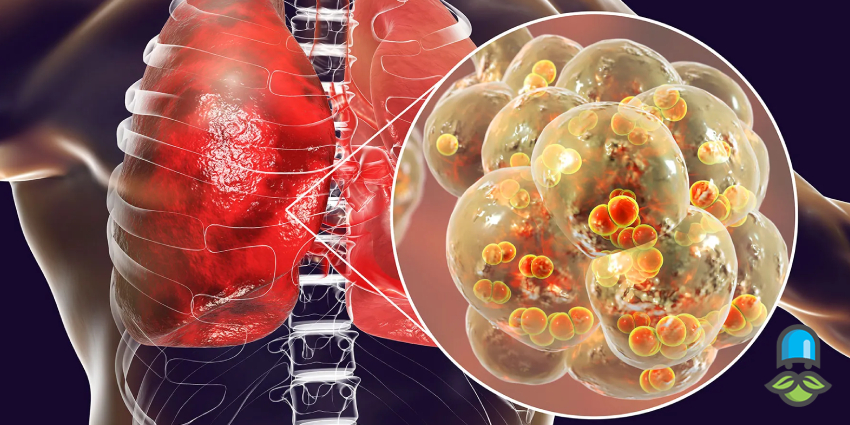 آیا کلیندامایسین برای عفونت دندان مناسب است؟