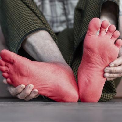 آشنایی با 7 علت داغ شدن کف پا و سوزنسوزن شدن