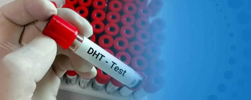 درباره هورمون DHT چه میدانید؟
