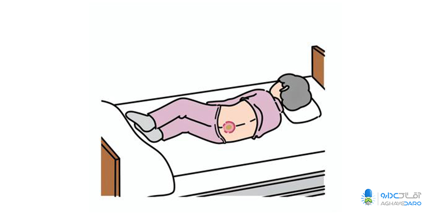 چه زمانی برای زخم بستر به پزشک مراجعه کنیم؟