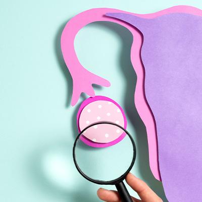 بهترین دارو برای کیست تخمدان را می‌شناسید؟
