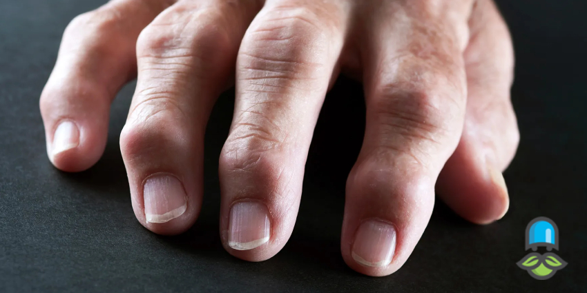 بررسی درمانهای موضعی مفاصل