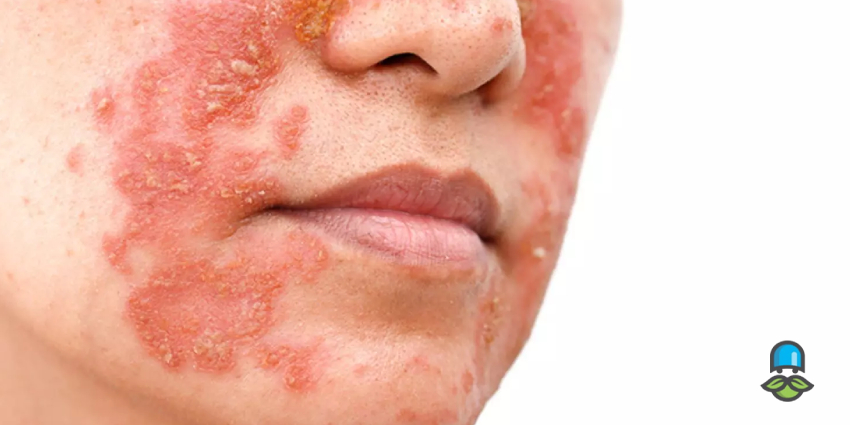 راهکارهای تغذیه‌ای برای دفع سموم پوستی