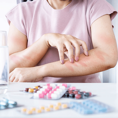 چه کسانی نباید آنتی هستامین مصرف کنند؟ | همه نکات مهم و کاربردی 2025