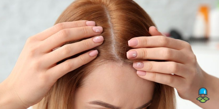 نحوه اثرگذاری گیاهان دارویی بر فولیکول مو