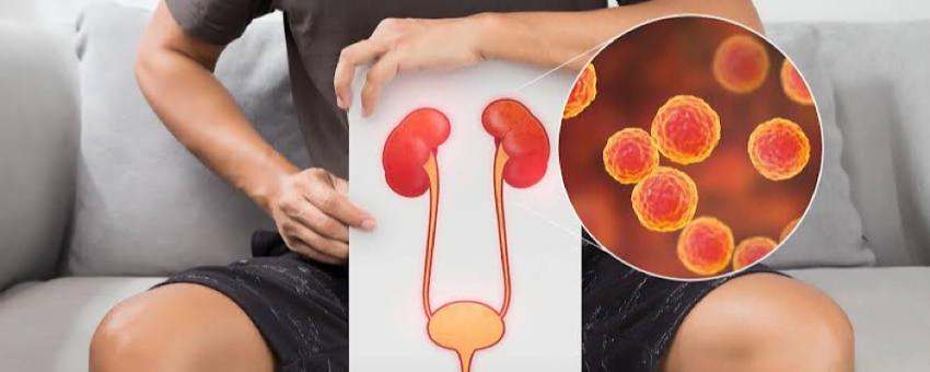 علائم عفونت کلیه + روشهای فوری درمان و پیشگیری از عوارض جدی