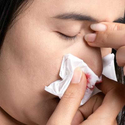 چرا دچار خونریزی بینی می‌شویم؟ مهم‌ترین دلایلی که باید بدانید