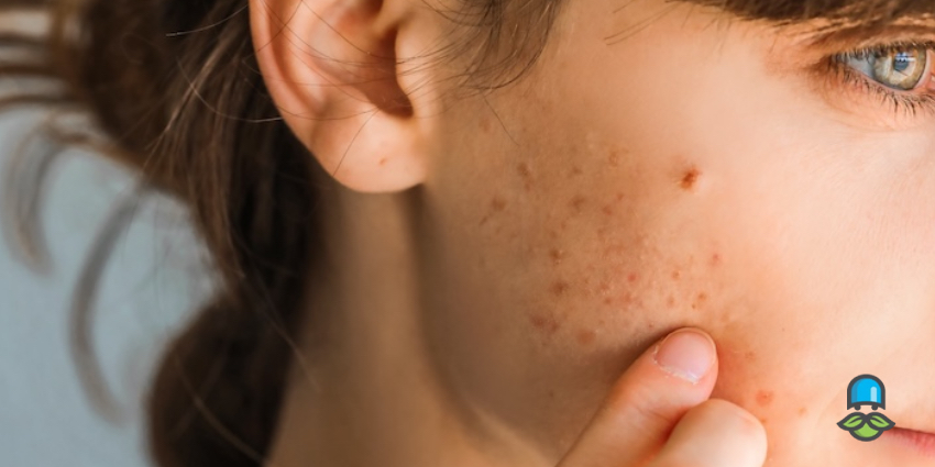 برنامه 14 روزه برای بهبود سلامت روده و پوست