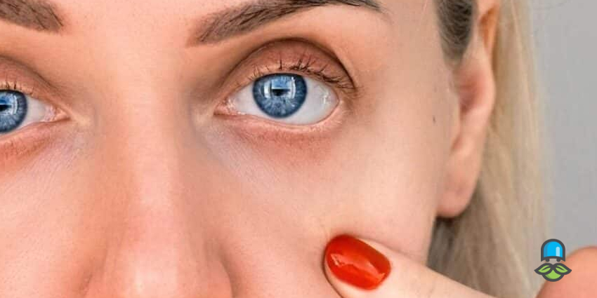 نحوه تشخیص علت گودی زیر چشم چگونه است؟