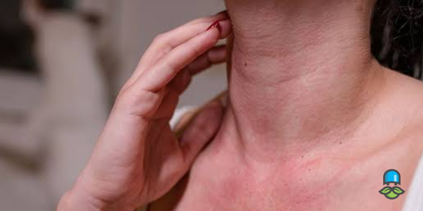چه افرادی بیشتر در معرض خطر ابتلا به شوک آنافیلاکسی هستند؟