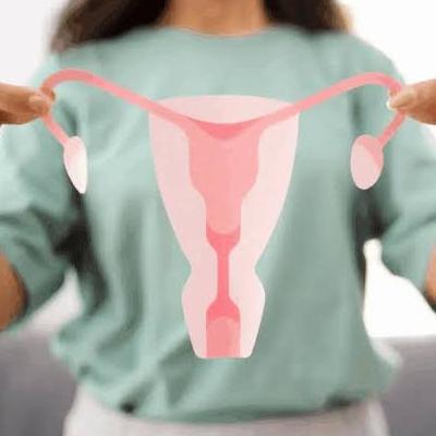 سندرم تخمدان پلی ‌کیستیک (PCOS): هر آنچه باید بدانید