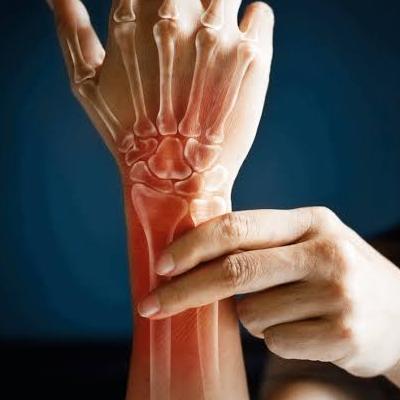 قرص استئو کینون چیست؟ از مهم‌ترین فواید تا عوارض آن