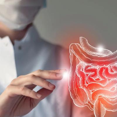 همه چیز درباره کولیت روده؛ علل، علائم و روش‌های درمان