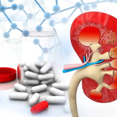 آیا کلسیم برای سنگ کلیه مضر است؟ مهمترین عوارض قرص کلسیم برای کلیه