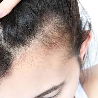 تاثیر هورمون‌ها بر مو: آیا کلید زیبایی در بدن ما نهفته است؟