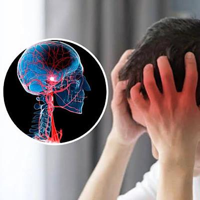 پیشگیری از سکته مغزی و روش‌هایی که باید بدانید