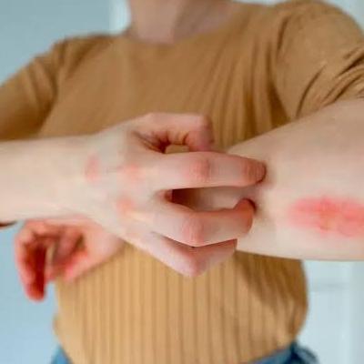 از علائم اولیه تا مهم‌ترین علل آنافیلاکسی