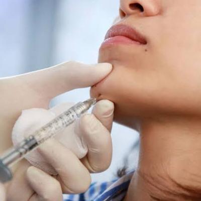 فیلرها راهکارهای جوانسازی پوست و رفع چین و چروک