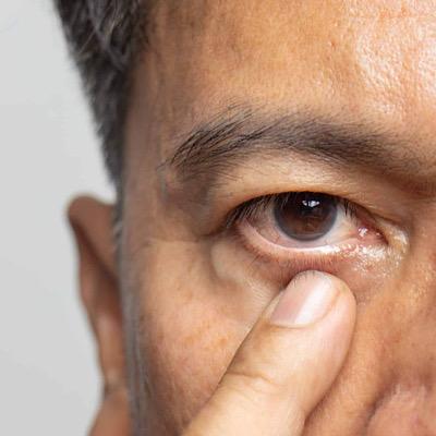 دلیل لرزش پلک چیست؟ آیا این نشانه‌ها برای شما آشناست؟
